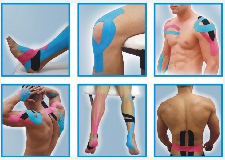 kinesiological taping